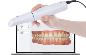 CAD/CAM intraorální skenery