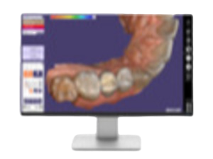 Exocad CAD/CAM software