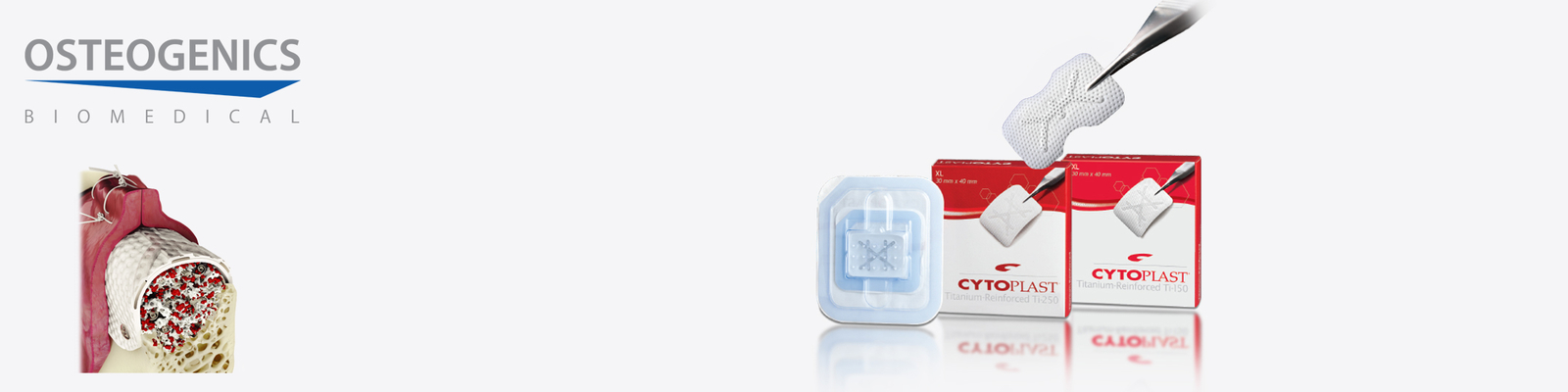 Osteogenics Cytoplast® Ti-250 titanem vyztužená PTFE membrána