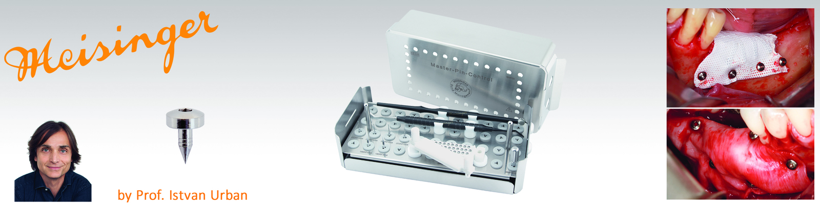 Bone Management Master Pin Control Piny pro fixaci membrány