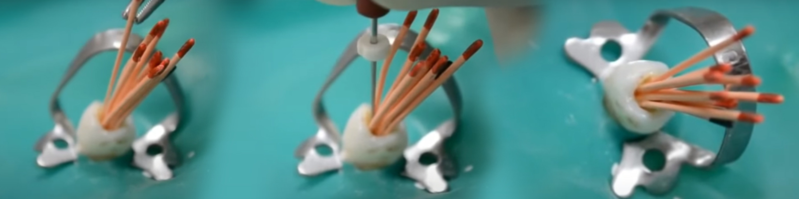 Nástroje na laterální kondenzaci