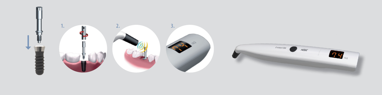 Přístroje pro okamžité měření stability implantátu