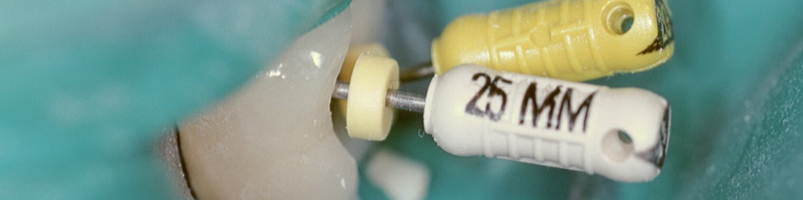 Ruční a ostatní endodontické nástroje