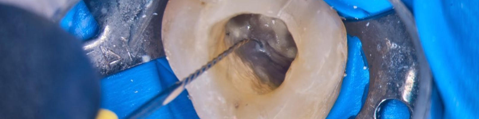 Nástroje pro vyhledání vstupu do kanálku