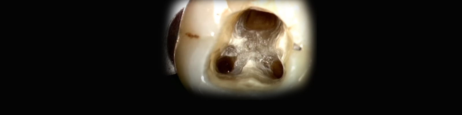 Nástroje pro vytvoření vstupu do kanálku