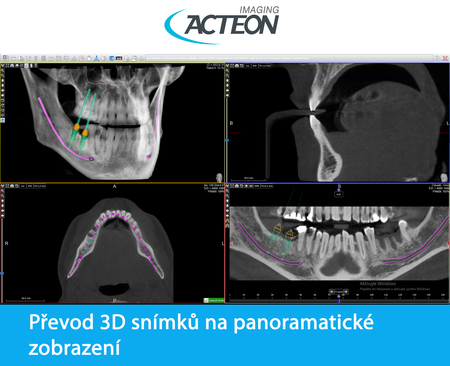 CBCT 3D kombinace 2D a 3D zobrazení